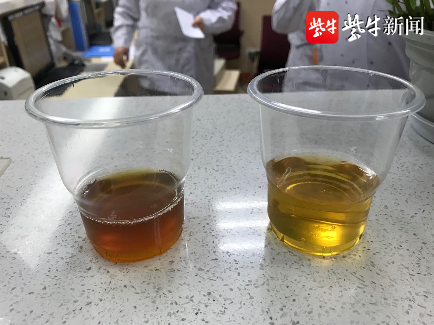 1岁男童吃几颗蚕豆出现"酱油尿 重度贫血