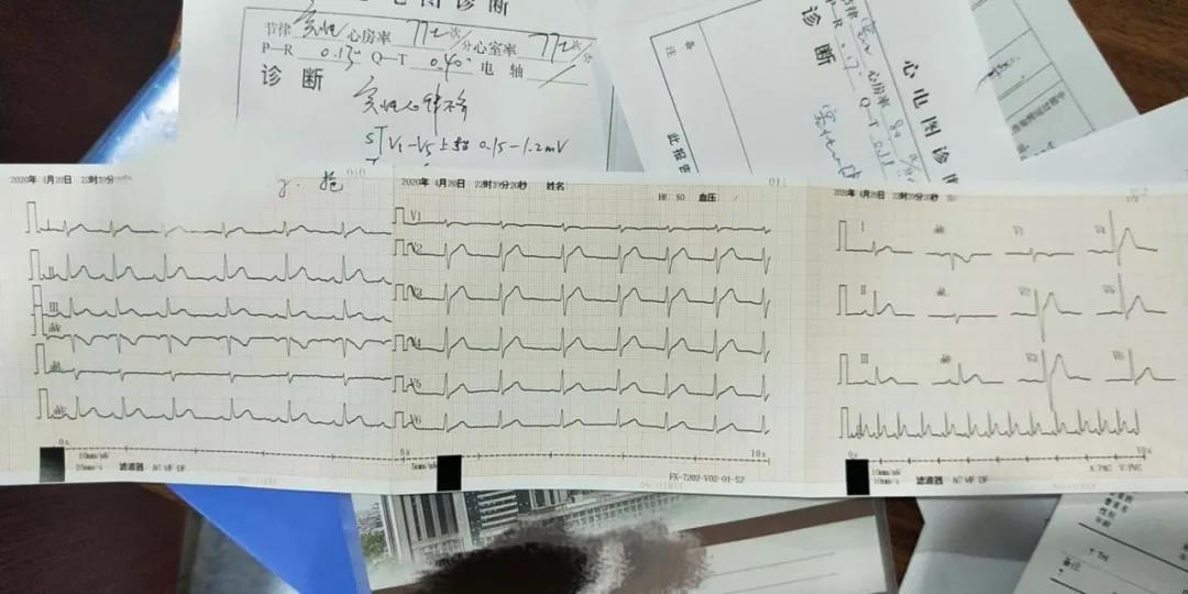 患者来院后首次心电图检查结果
