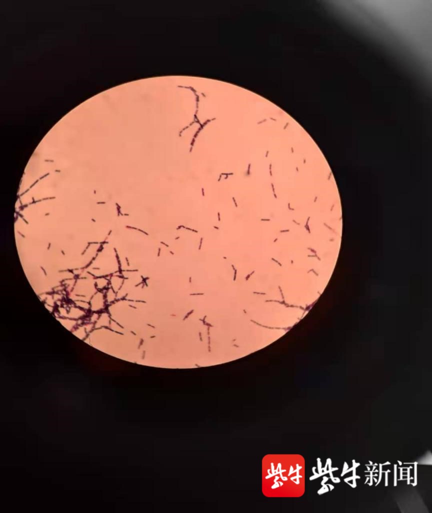 弯曲杆菌显微镜图片图片