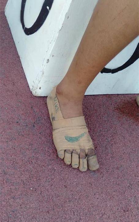 菲律宾女孩没钱买跑鞋,用绷带裹脚参赛,拿3块金牌!