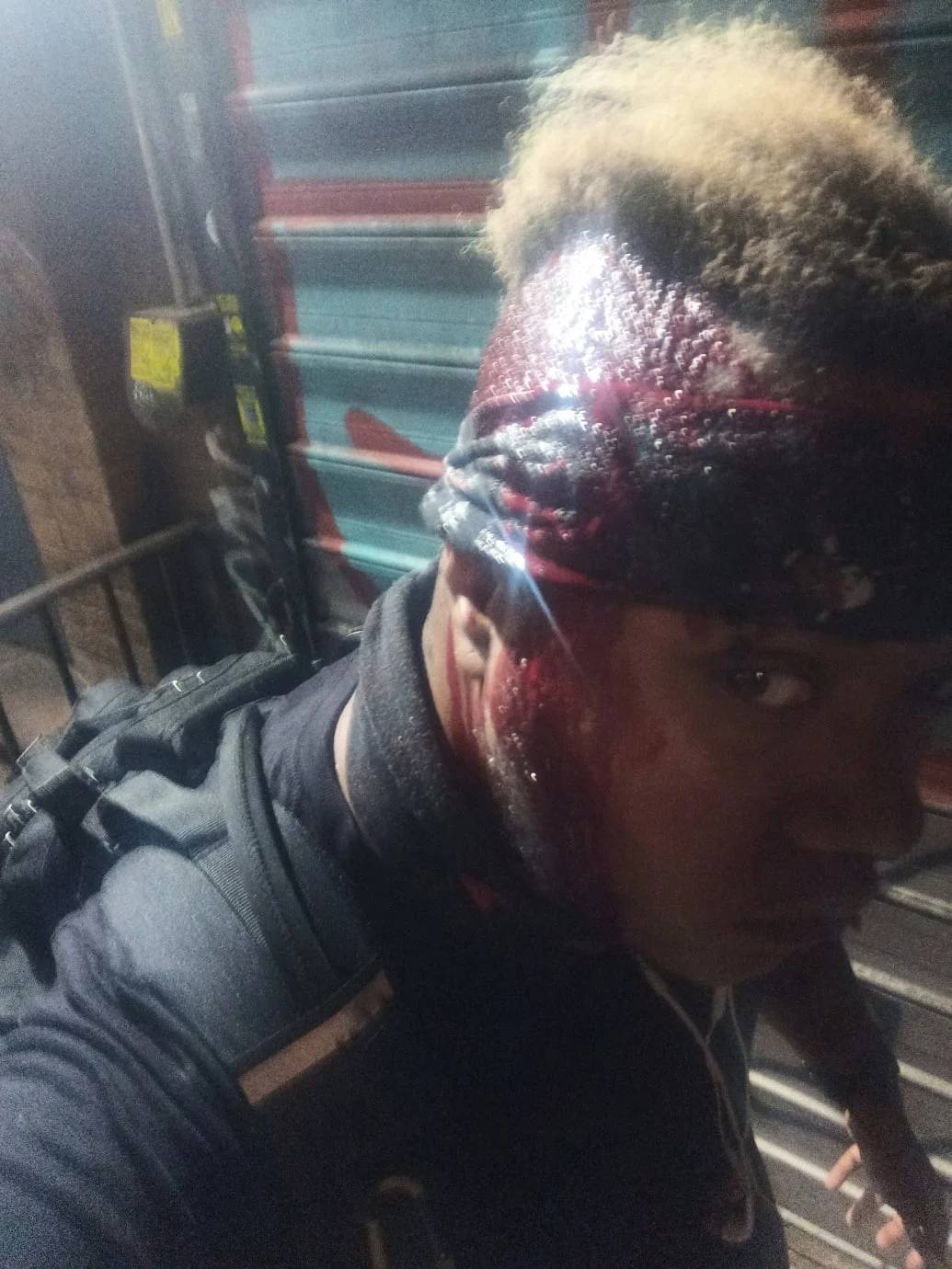 瓦伦丁头部受伤(图片由瓦伦丁提供)