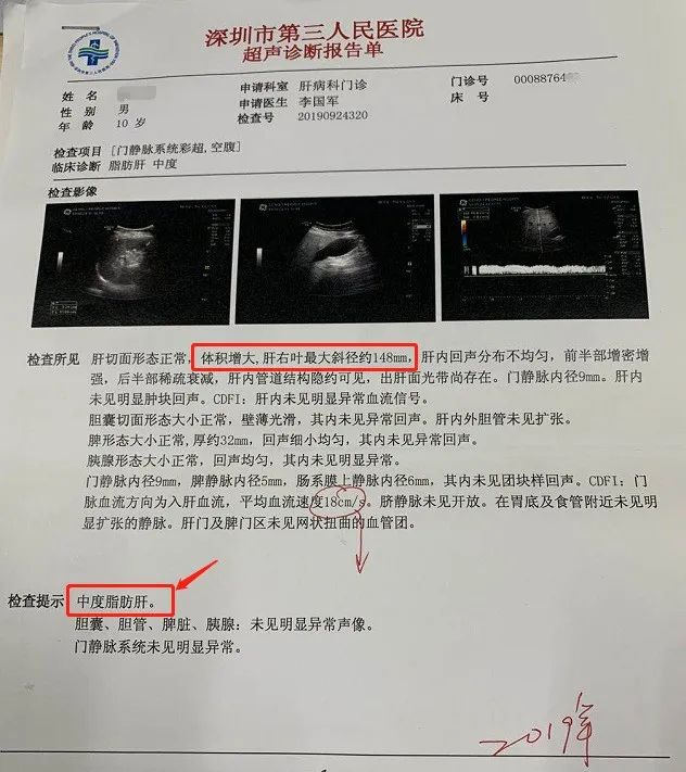 核磁报告单图片