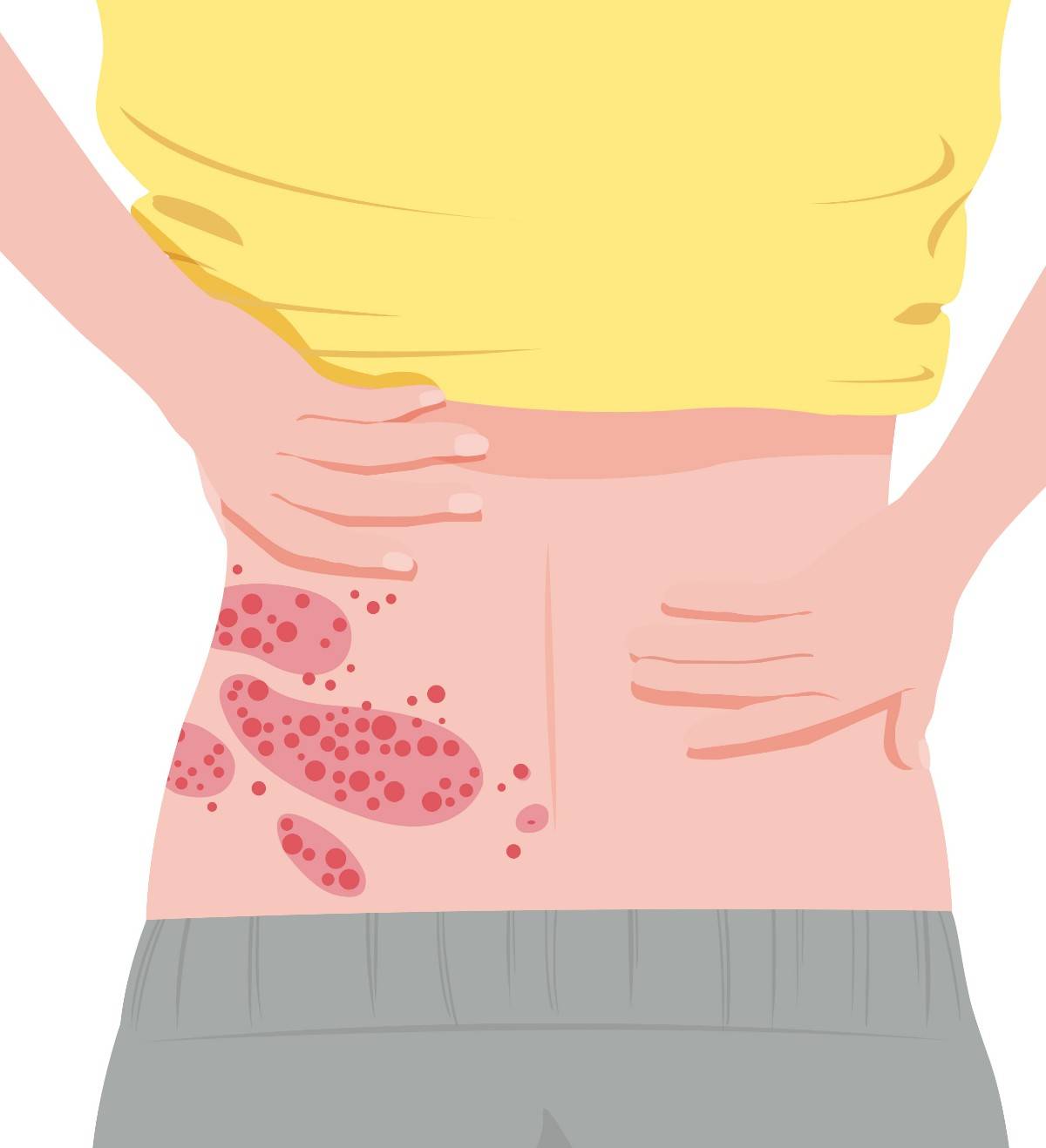 "缠腰龙"疫苗优惠500元!两针总价普遍超4400元