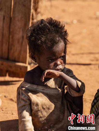 世界上饥饿的儿童图片