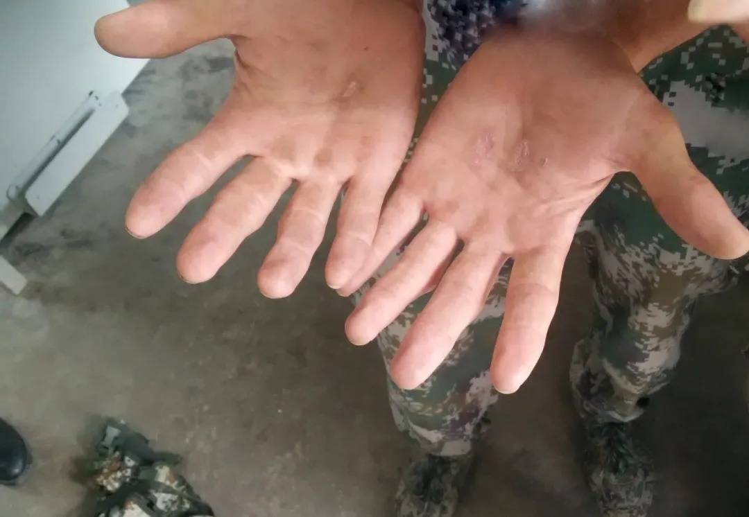 第一!00后大学生成特战女兵"神枪手",双手让人心疼