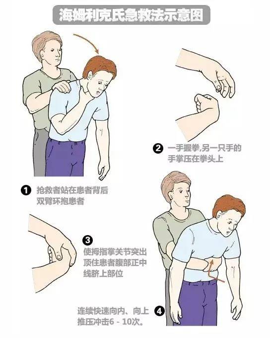 世界急救日:一起get日常生活中的急救方法