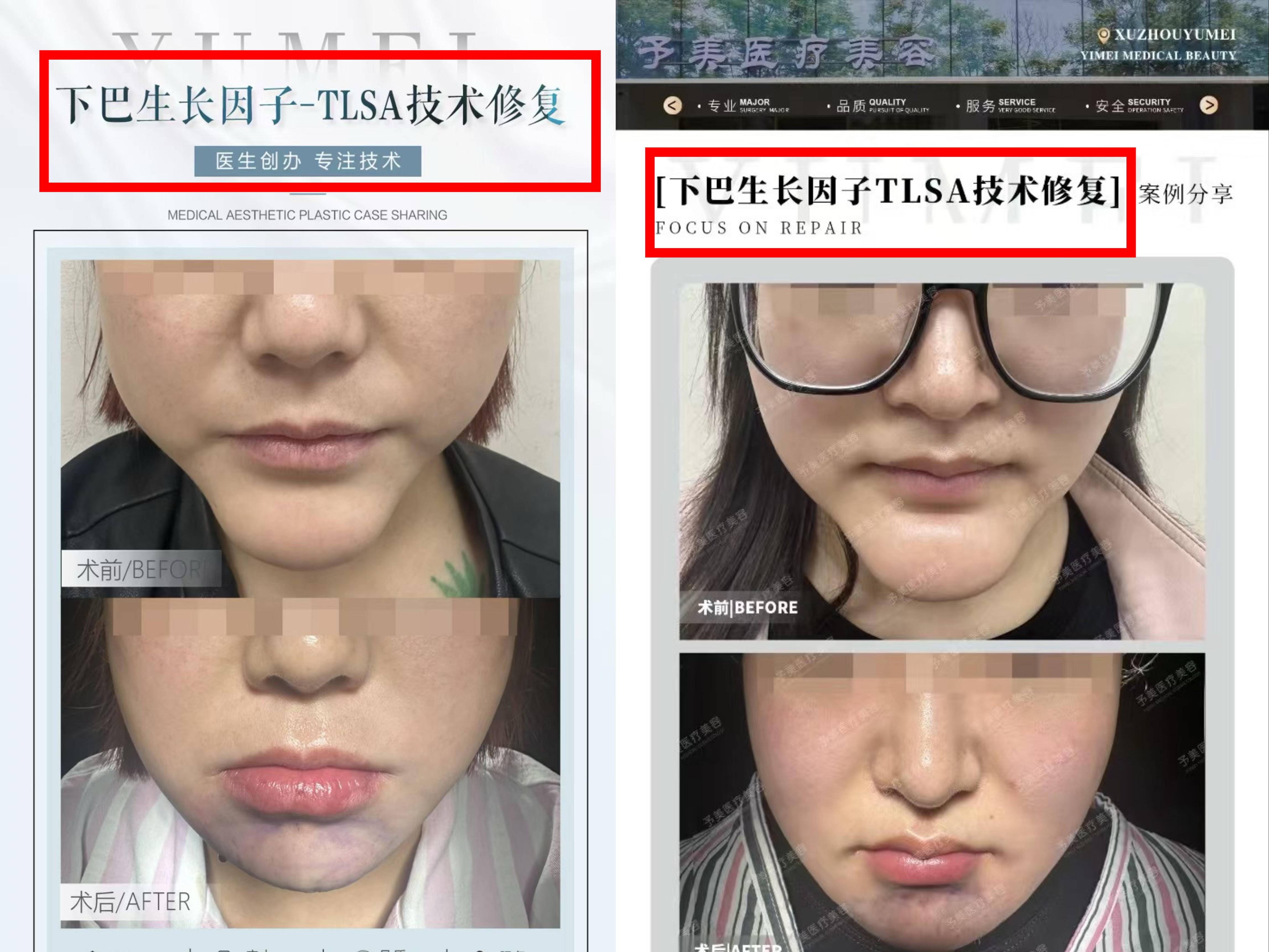 
                        4:3图片
