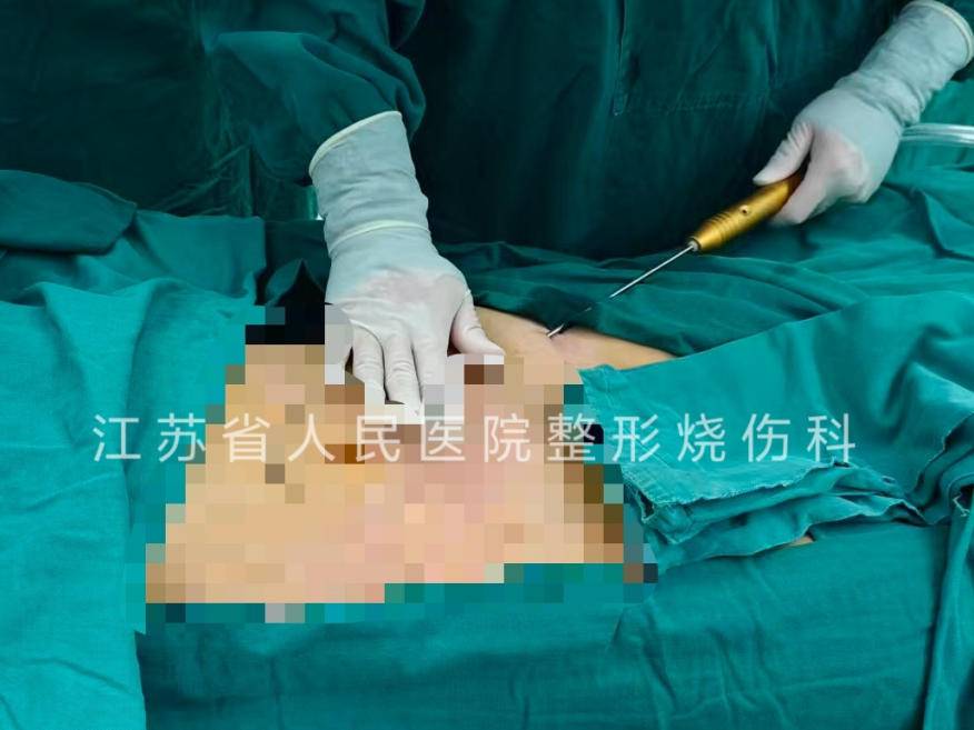 
                        4:3图片