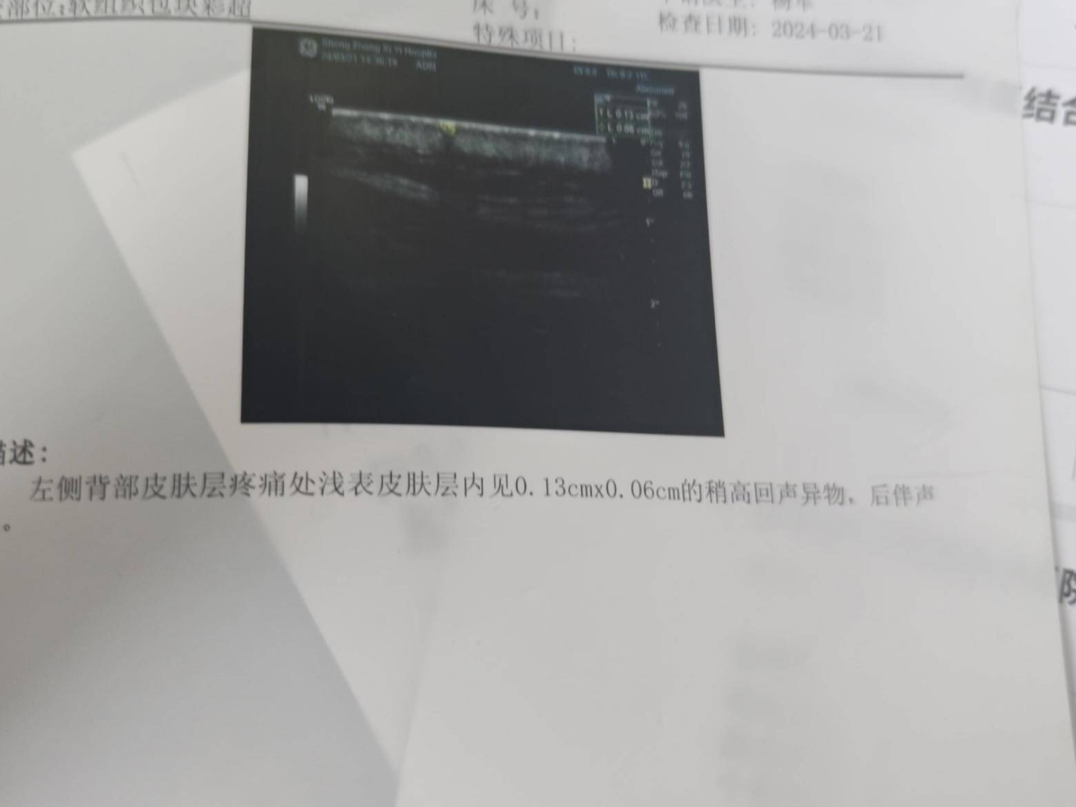 
                        4:3图片