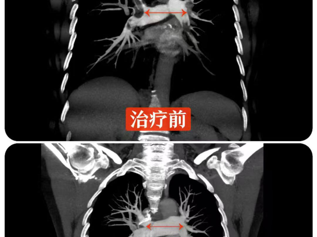 
                        4:3图片