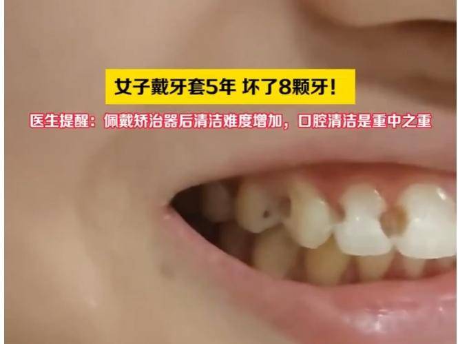 
                        4:3图片