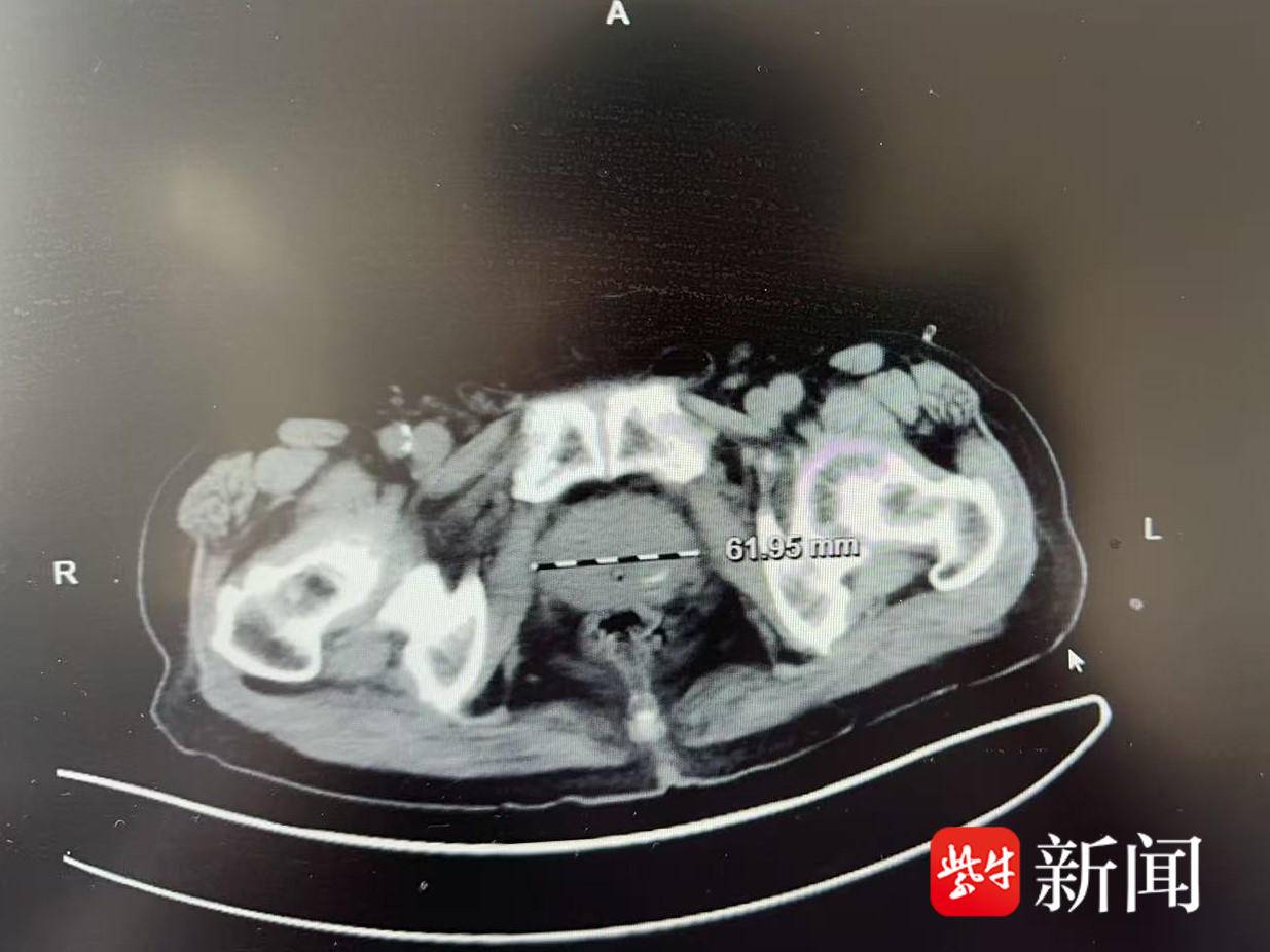 
                        4:3图片