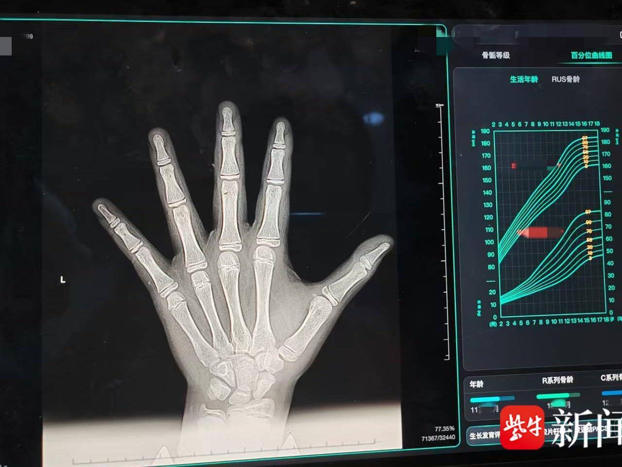 
                        4:3图片
