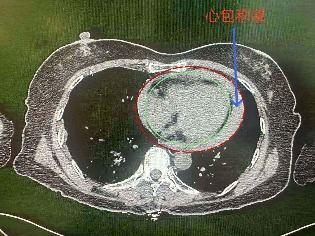 
                        4:3图片
