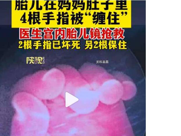 
                        4:3图片